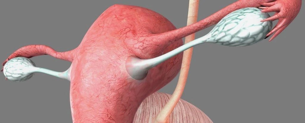 Tubal Recanalization for Fertility Restoration