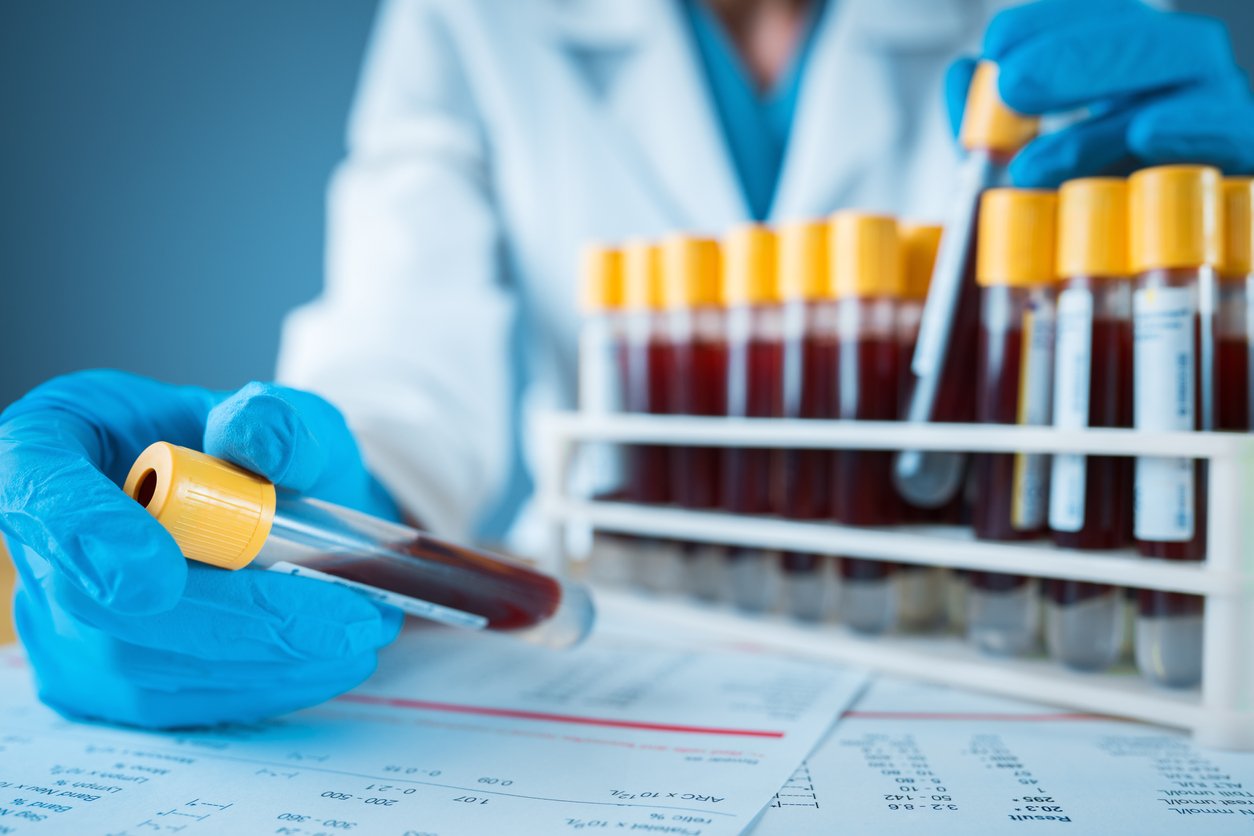 Lab Investigation